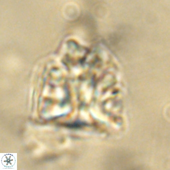 Fasciculithus bobbii VR 00042