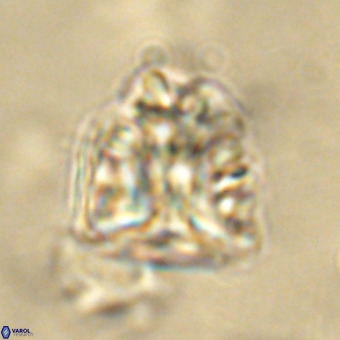 Fasciculithus bobbii VR 00043