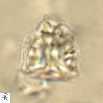 Fasciculithus bobbii VR 00043
