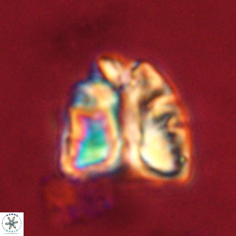 Fasciculithus bobbii VR 00045