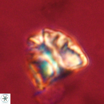 Fasciculithus bobbii VR 00047
