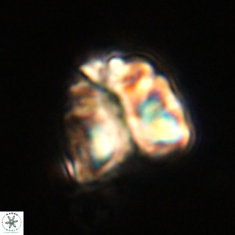 Fasciculithus bobbii VR 00050