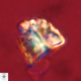 Fasciculithus bobbii VR 00051