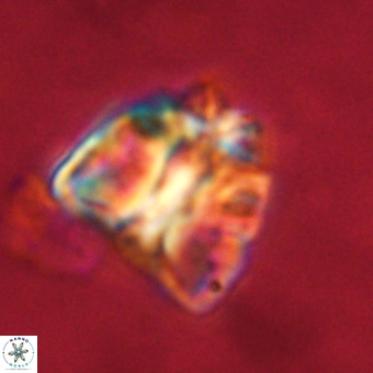 Fasciculithus bobbii VR 00054