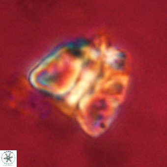 Fasciculithus bobbii VR 00055