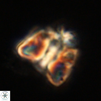 Fasciculithus bobbii VR 00056