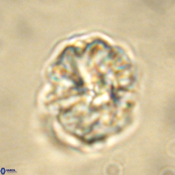 Fasciculithus bobbii VR 00036
