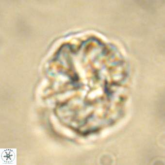 Fasciculithus bobbii VR 00036
