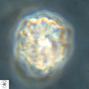 Fasciculithus bobbii VR 00037