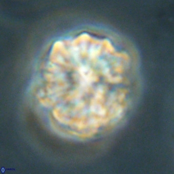 Fasciculithus bobbii VR 00038