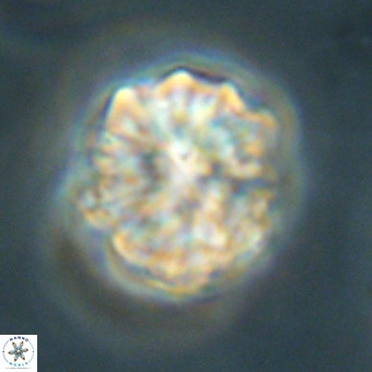 Fasciculithus bobbii VR 00038