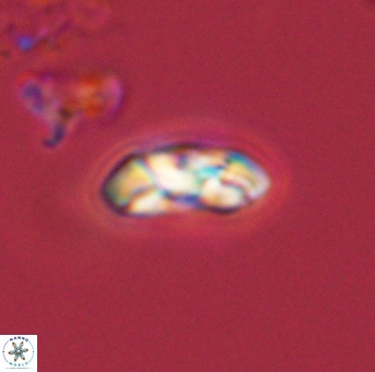 Foteinosolines supremus 45164
