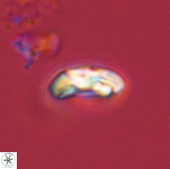 Foteinosolines supremus 45167