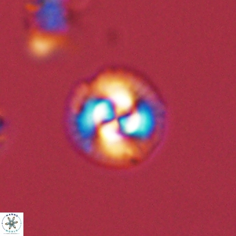 Foteinosolines supremus 45172