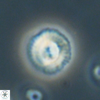 Foteinosolines supremus 68191