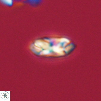 Foteinosolines supremus 68223