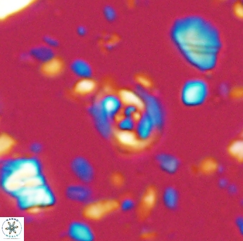 Flabellites eclepensensis 13245