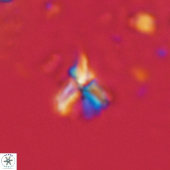 Furcatolithus avis 147