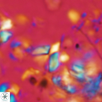 Furcatolithus avis 164