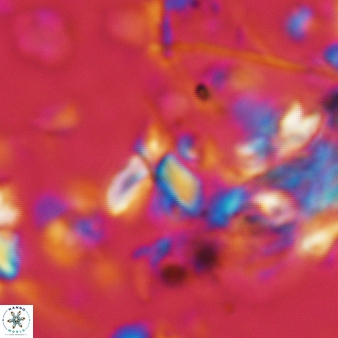 Furcatolithus avis 165
