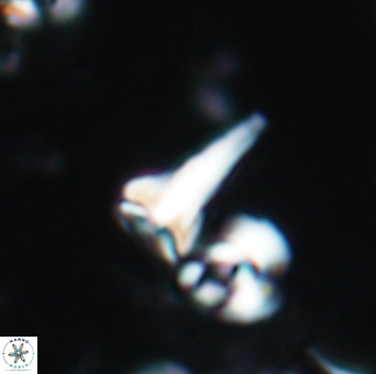 Furcatolithus celsus 1949
