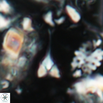 Furcatolithus ciperoensis 170