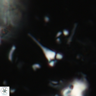 Furcatolithus distentus 151