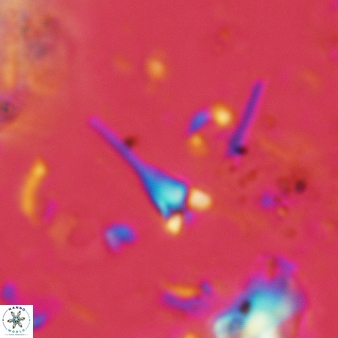 Furcatolithus distentus 152