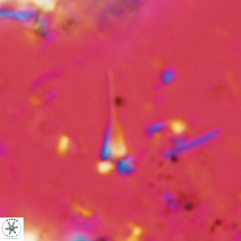 Furcatolithus distentus 153