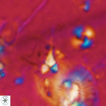 Furcatolithus distentus 181