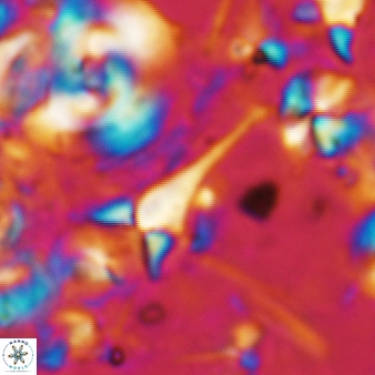 Furcatolithus humerus 203