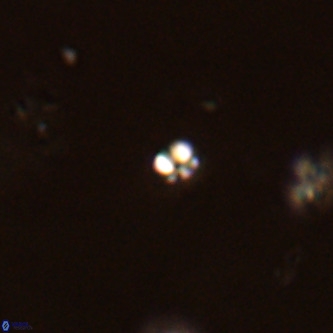 Futyania patelosus VR 01776