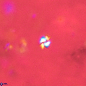 Futyania patelosus VR 01806