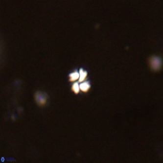 Futyania patelosus VR 01811