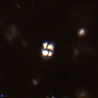 Futyania patelosus VR 01814