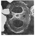 Grantarhabdus meddii 12827