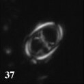 Asynithistostoichos coxalliae 40376