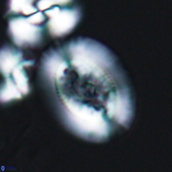 Gaarderella granulifera 12882