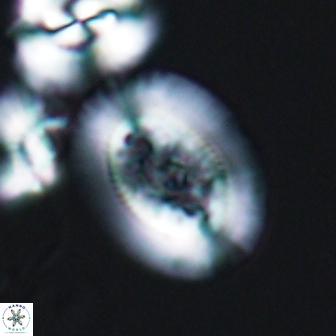 Gaarderella granulifera 12882