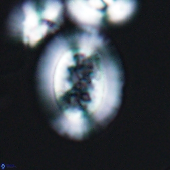 Gaarderella granulifera 12884