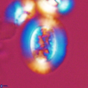 Gaarderella granulifera 12885