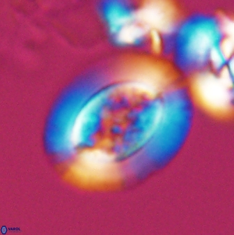 Gaarderella granulifera 12887