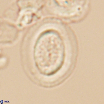 Gaarderella granulifera 12888