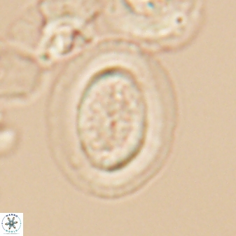 Gaarderella granulifera 12888