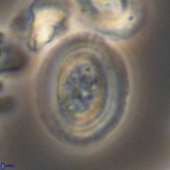 Gaarderella granulifera 12890