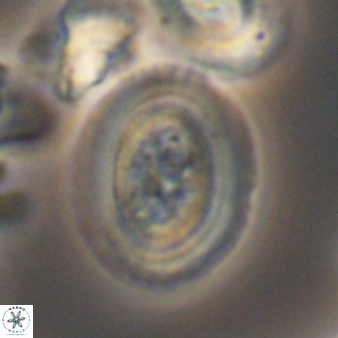 Gaarderella granulifera 12890