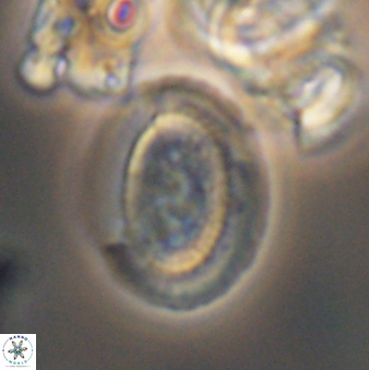 Gaarderella granulifera 12892