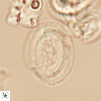 Gaarderella granulifera 12893