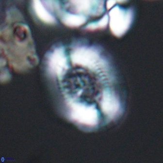 Gaarderella granulifera 12894