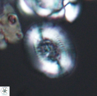 Gaarderella granulifera 12894